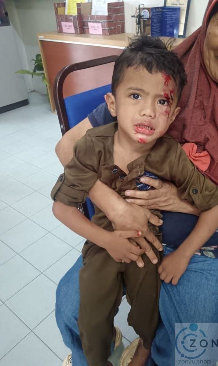 Kanak-Kanak Tiga Tahun Cedera Jatuh dari Kereta Dipandu Bapa